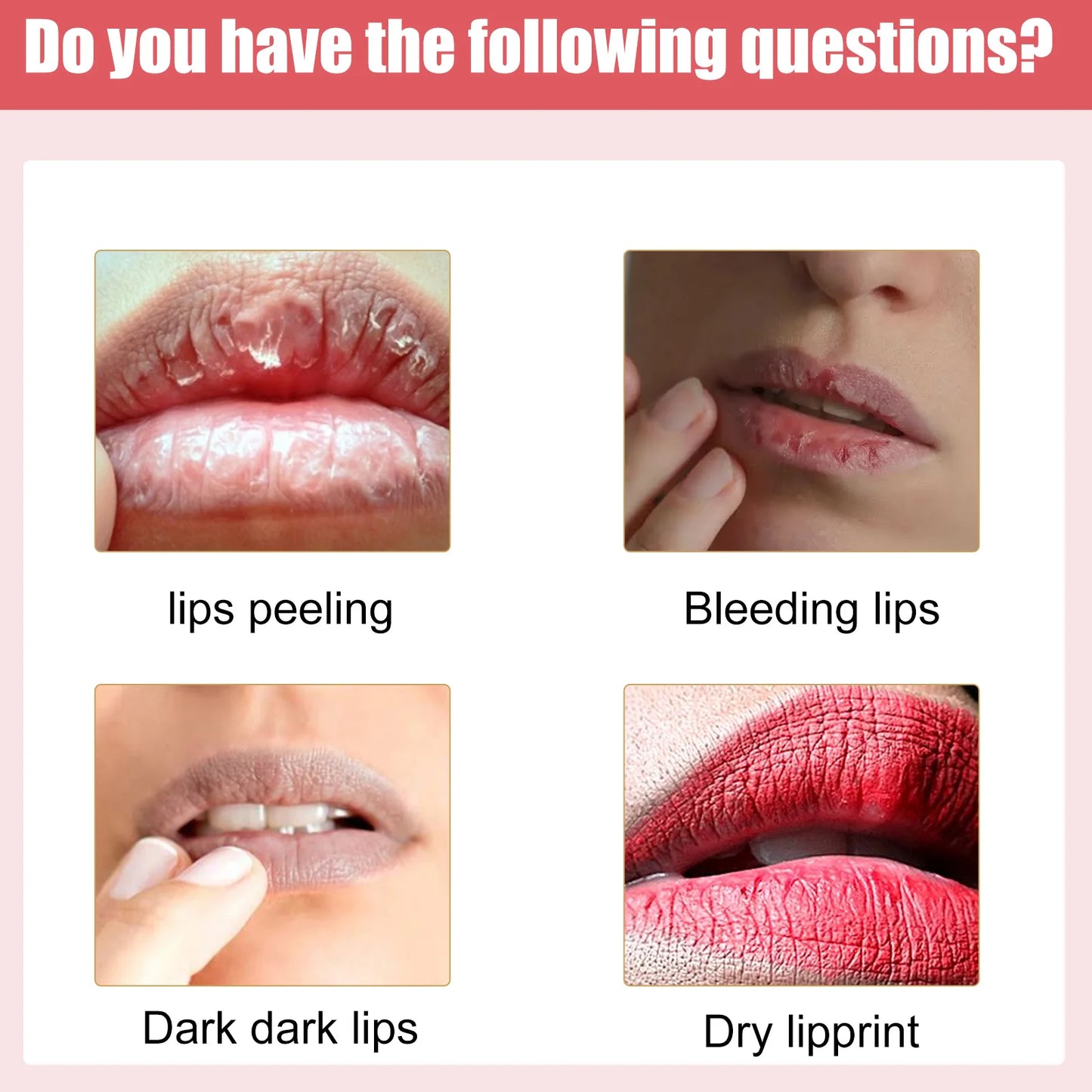 Moisturizing, Nourishing, Lip Lightening Cream