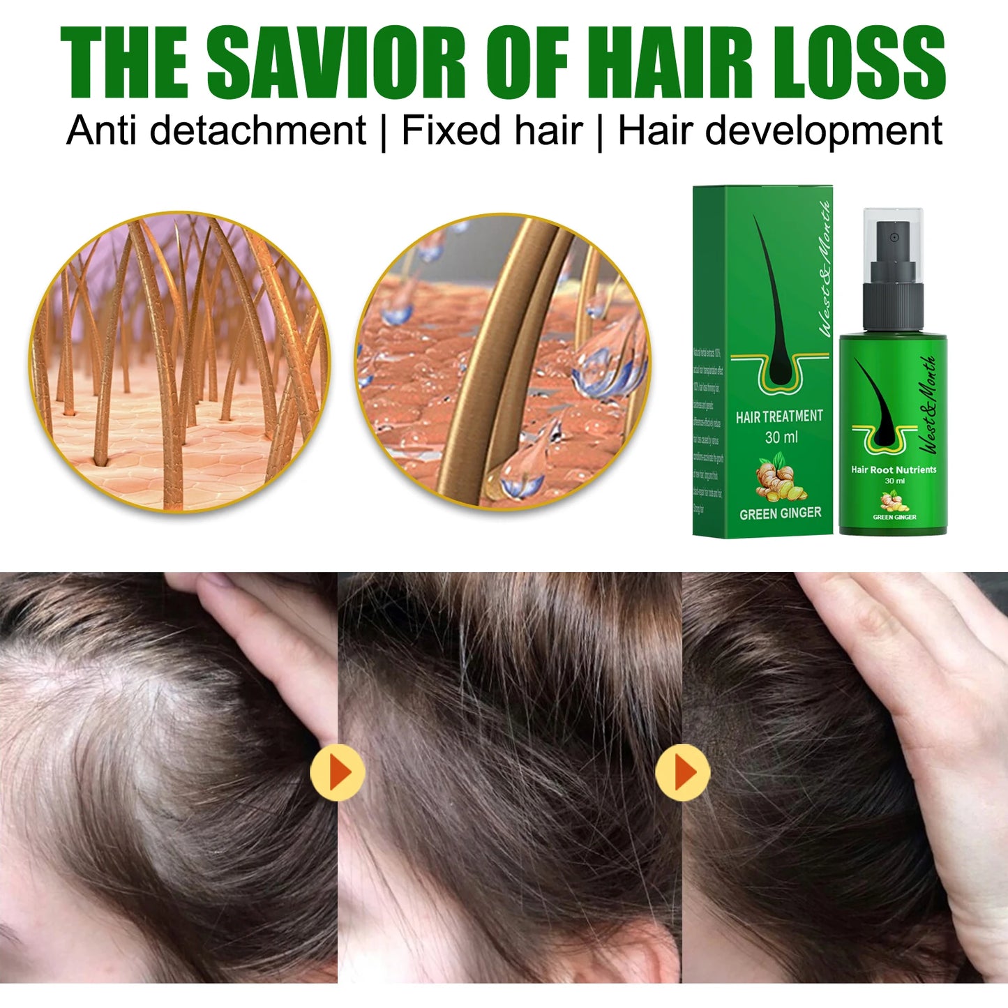Hair Root Nutrients for Promoting Hair Growth